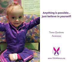 Girl with Turner Syndrome